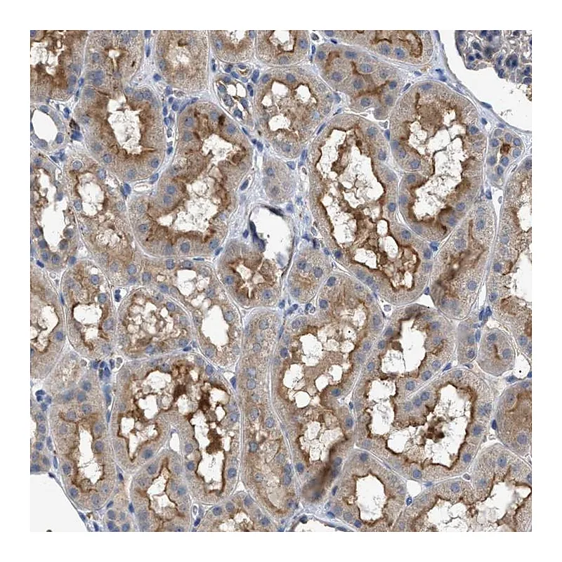 Atlas Antibodies Anti-VSTM2A Antibody