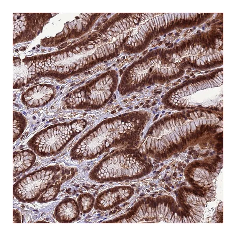 Atlas Antibodies Anti-VSTM4 Antibody