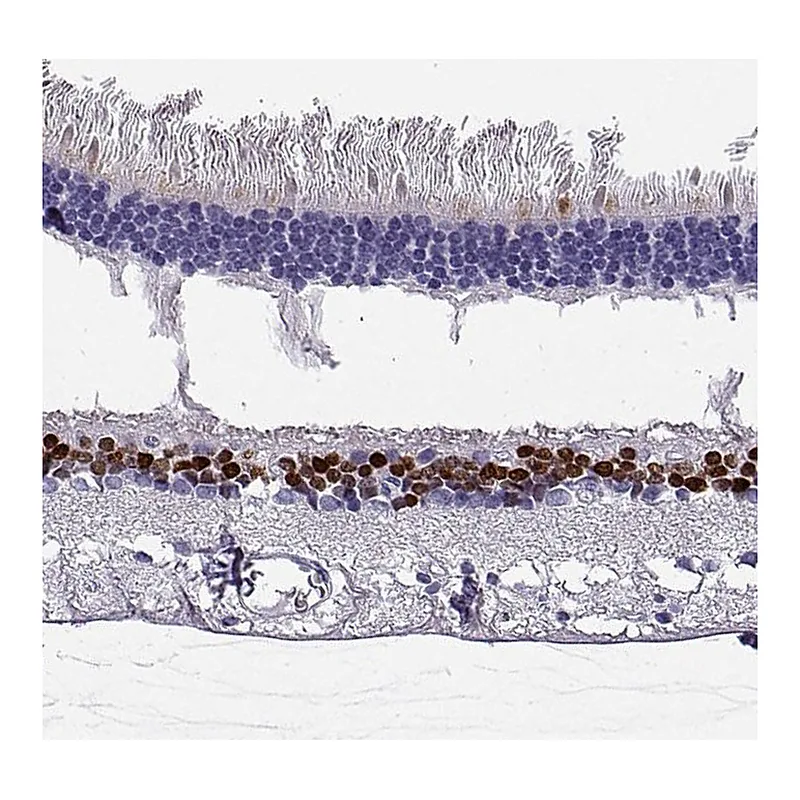 Atlas Antibodies Anti-VSX2 Antibody