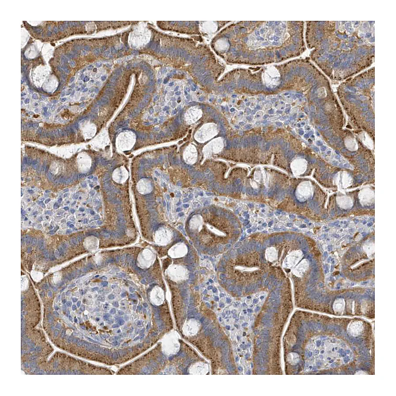 Atlas Antibodies Anti-VTA1 Antibody