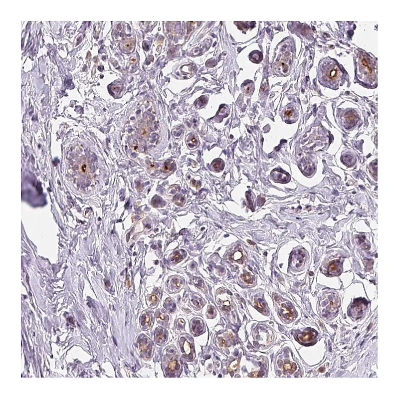 Atlas Antibodies Anti-VTCN1 Antibody