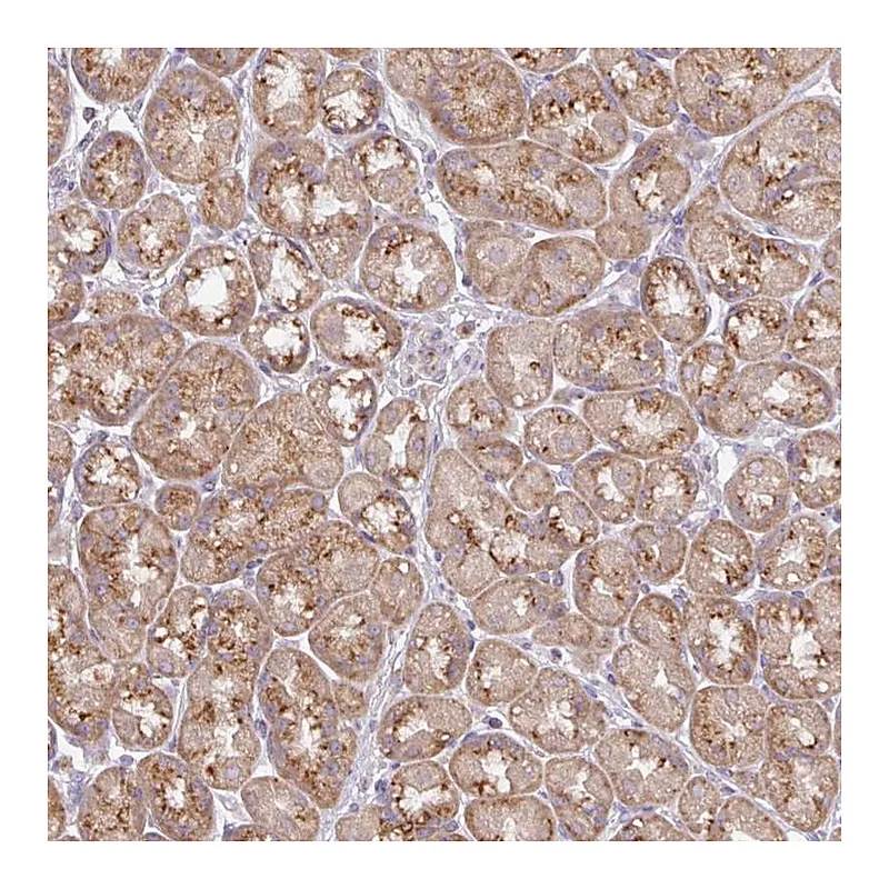 Atlas Antibodies Anti-VTI1A Antibody