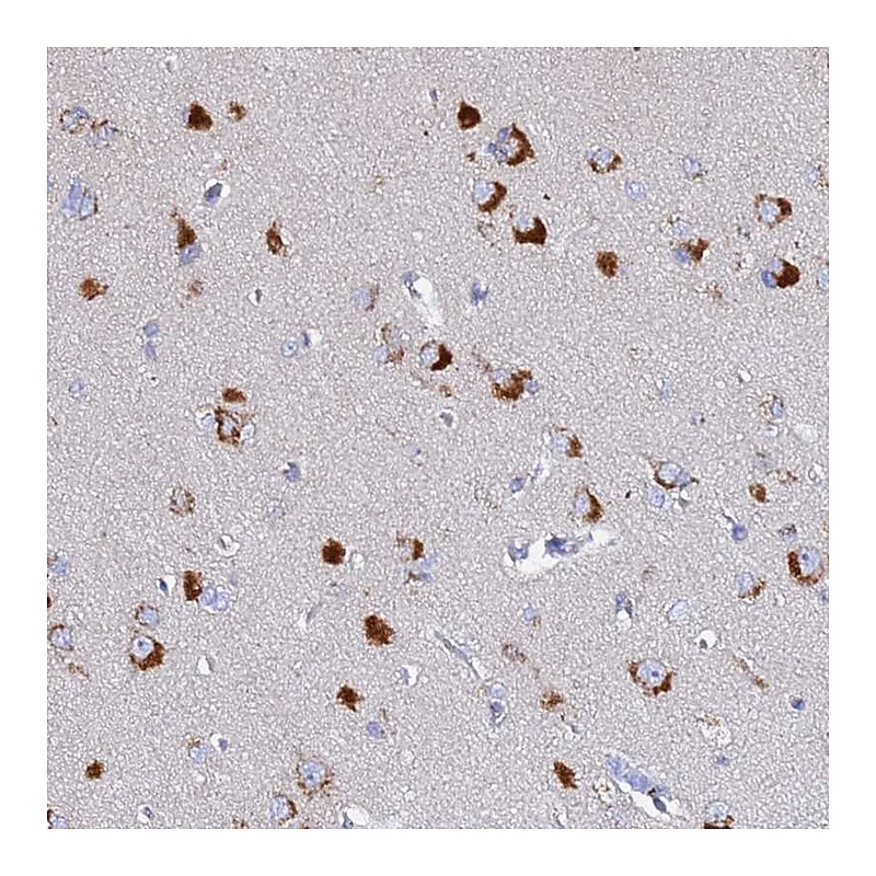 Atlas Antibodies Anti-VTI1B Antibody