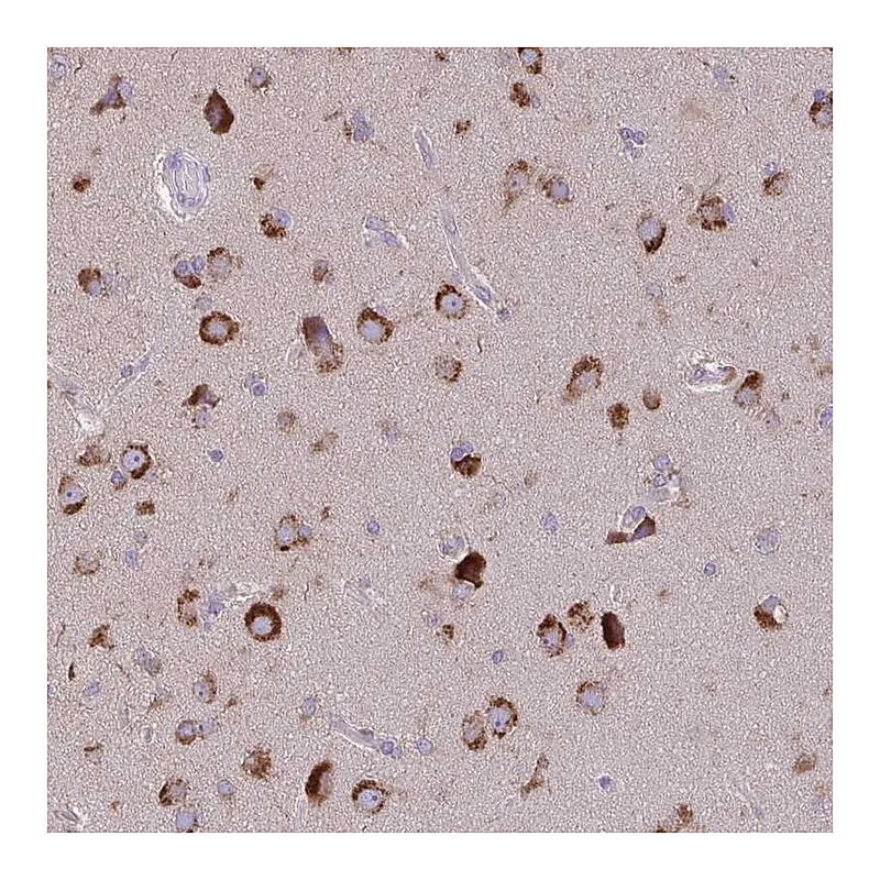 Atlas Antibodies Anti-VTI1B Antibody