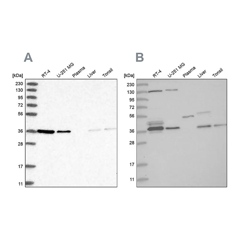Atlas Antibodies Anti-VTA1 Antibody