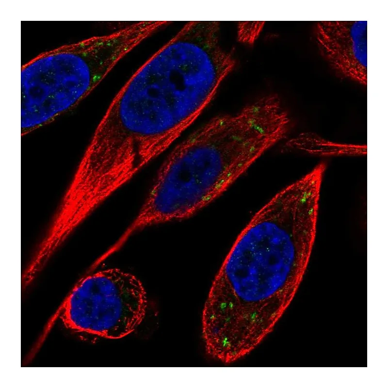 Atlas Antibodies Anti-VTI1B Antibody