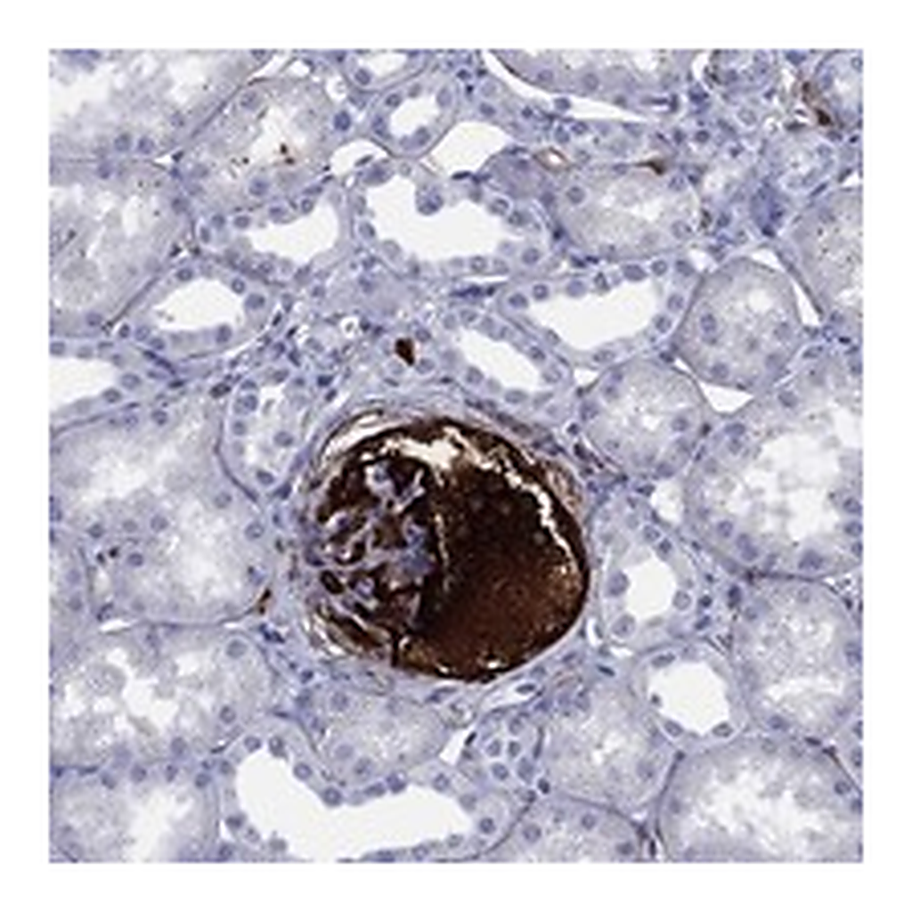 Atlas Antibodies Anti-VTN Antibody