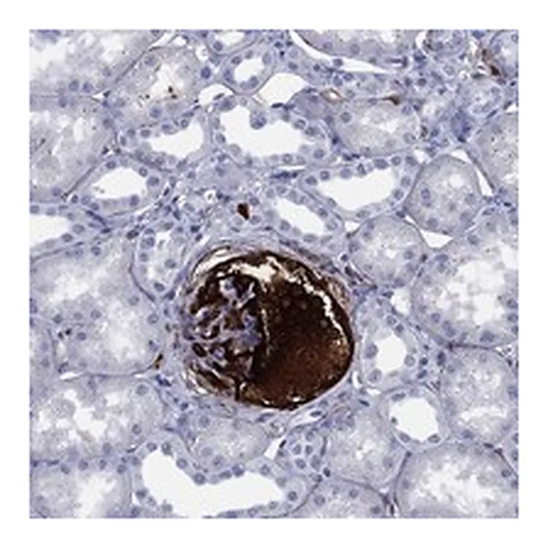 Atlas Antibodies Anti-VTN Antibody