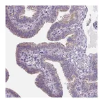 Atlas Antibodies Anti-VWA3B Antibody