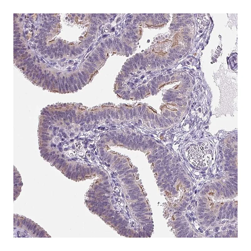 Atlas Antibodies Anti-VWA3B Antibody