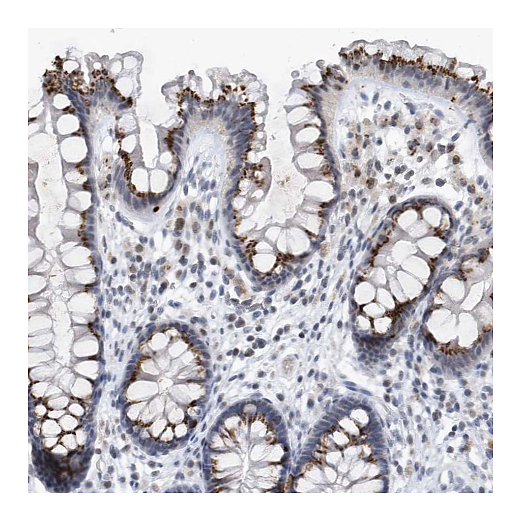 Atlas Antibodies Anti-VWA5B2 Antibody