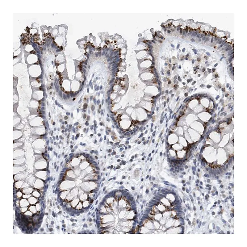 Atlas Antibodies Anti-VWA5B2 Antibody