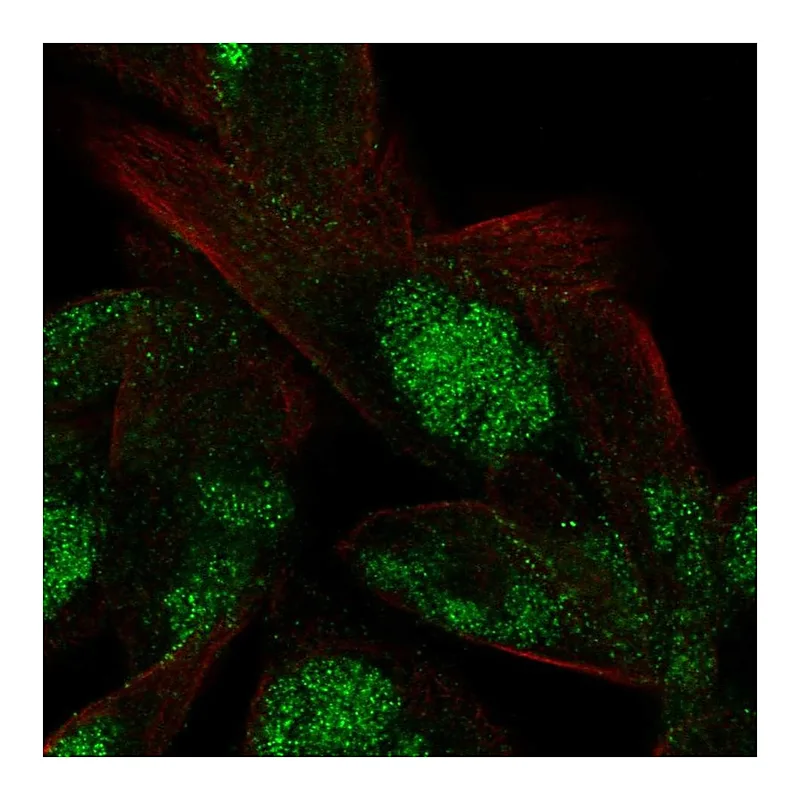 Atlas Antibodies Anti-VWA5A Antibody