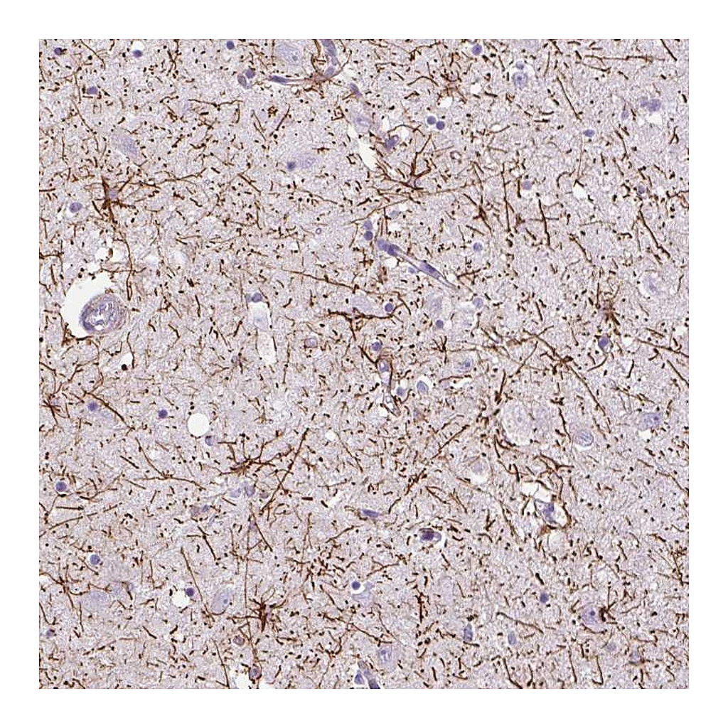 Atlas Antibodies Anti-VWA7 Antibody