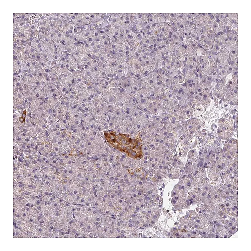 Atlas Antibodies Anti-VWA5B2 Antibody