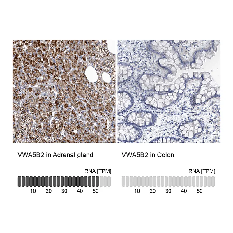 Atlas Antibodies Anti-VWA5B2 Antibody