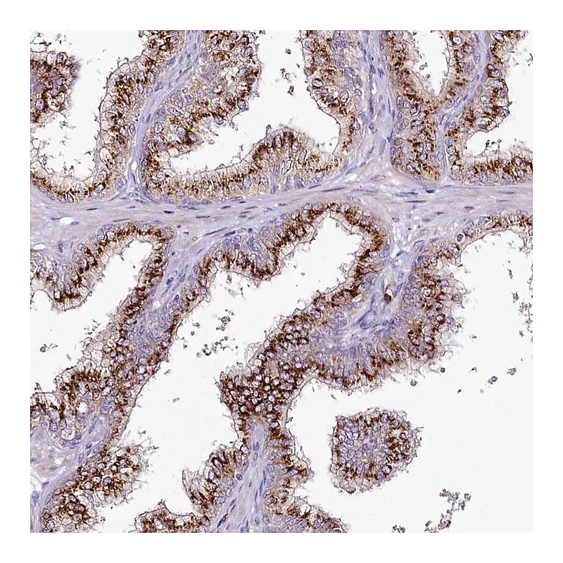 Atlas Antibodies Anti-VWA5A Antibody