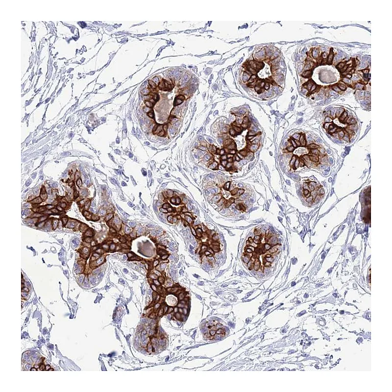 Atlas Antibodies Anti-VWA8 Antibody