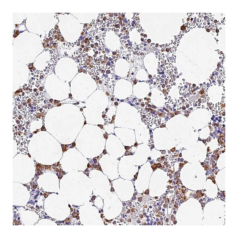 Atlas Antibodies Anti-VWC2L Antibody