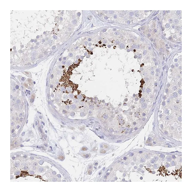 Atlas Antibodies Anti-VWC2L Antibody