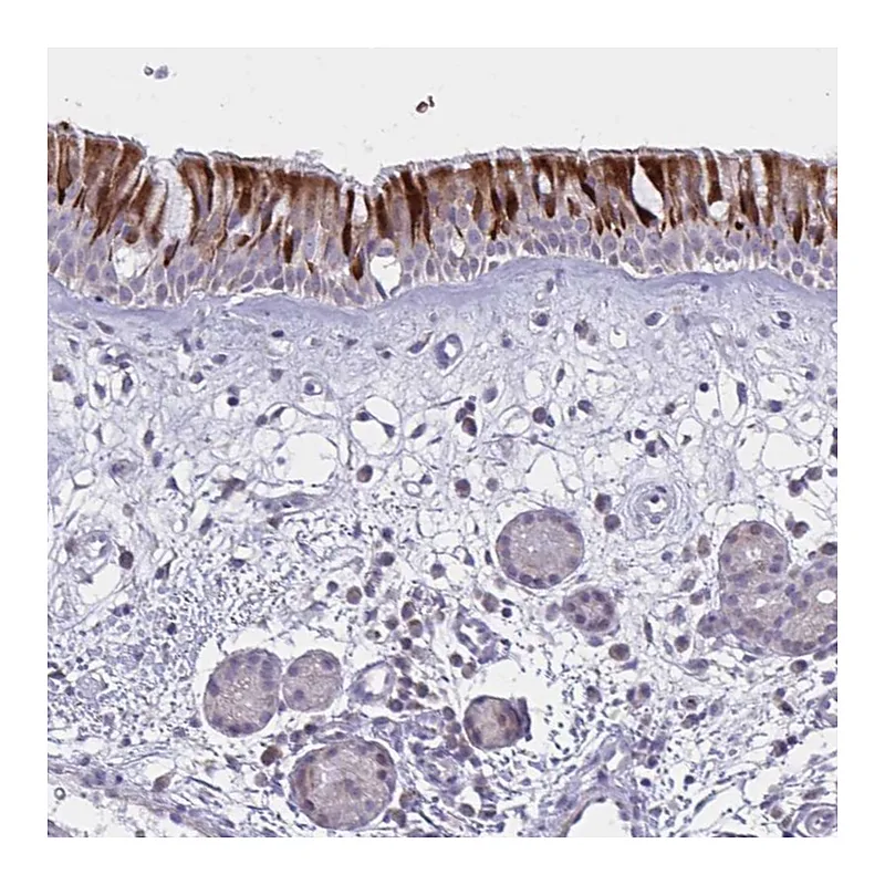 Atlas Antibodies Anti-VWC2 Antibody