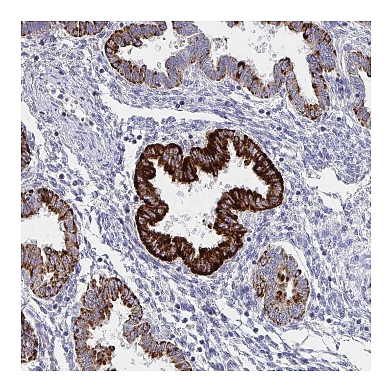 Atlas Antibodies Anti-VWDE Antibody