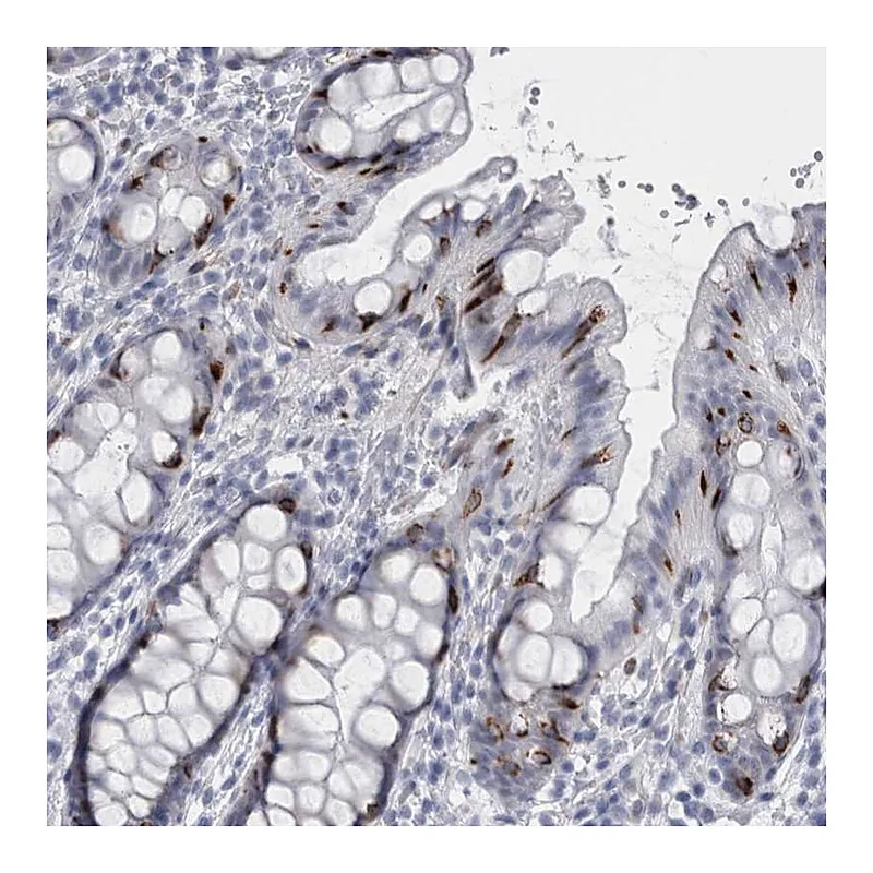 Atlas Antibodies Anti-VWDE Antibody