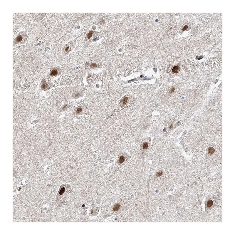 Atlas Antibodies Anti-WAC Antibody