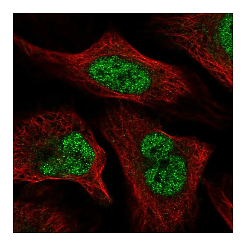 Atlas Antibodies Anti-WAC Antibody