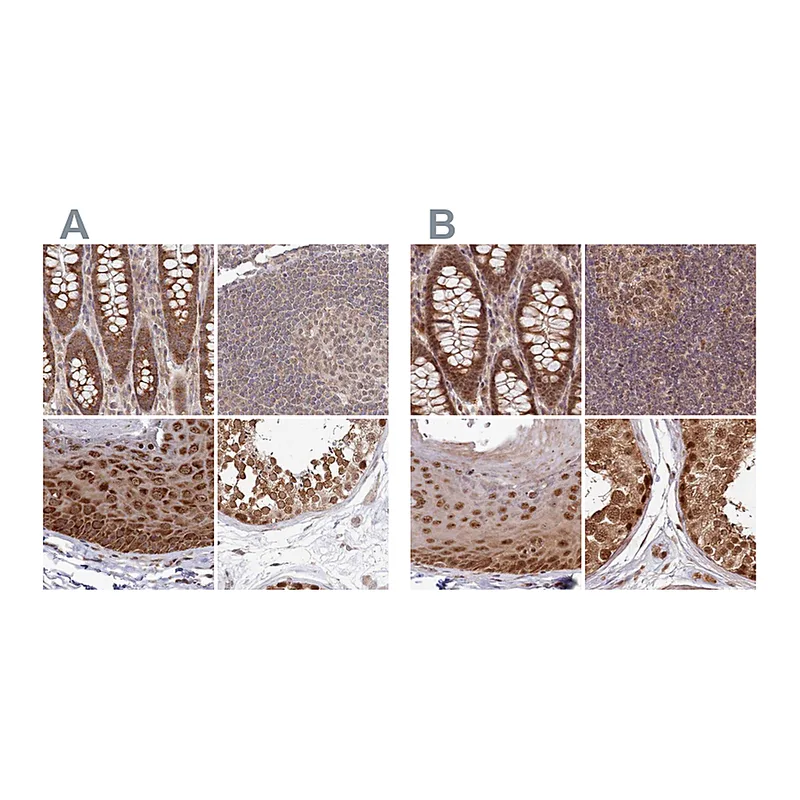 Atlas Antibodies Anti-WAPL Antibody