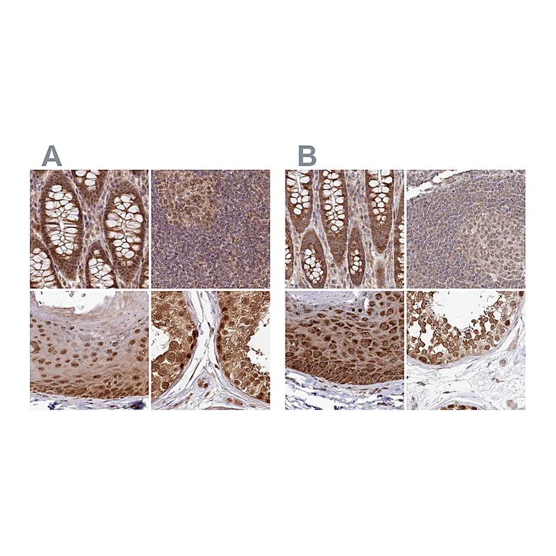 Atlas Antibodies Anti-WAPL Antibody