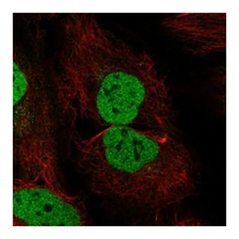 Atlas Antibodies Anti-WAPL Antibody