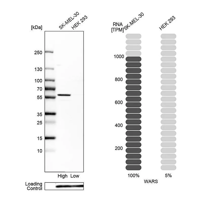 Atlas Antibodies Anti-WARS Antibody