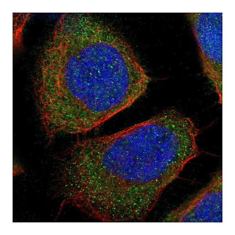 Atlas Antibodies Anti-WARS Antibody