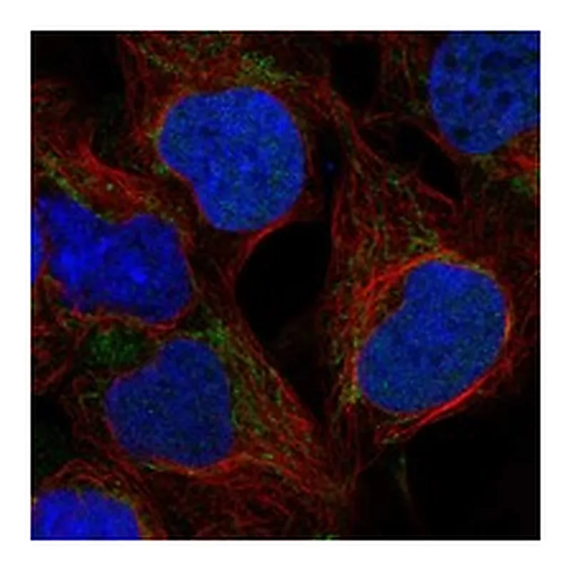 Atlas Antibodies Anti-WARS2 Antibody