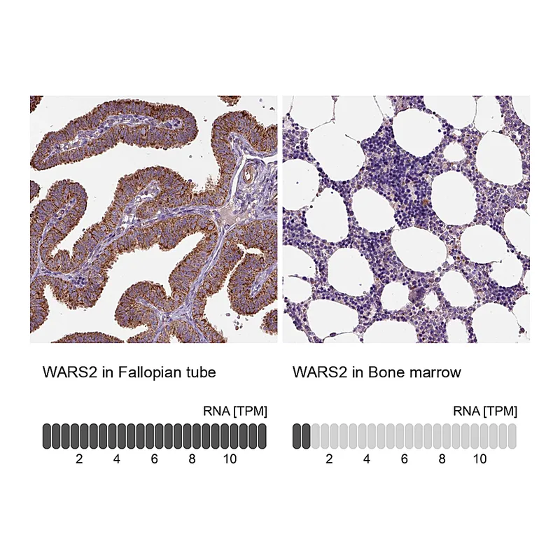 Atlas Antibodies Anti-WARS2 Antibody