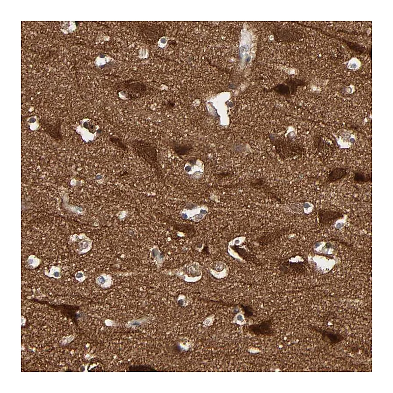 Atlas Antibodies Anti-WASF1 Antibody