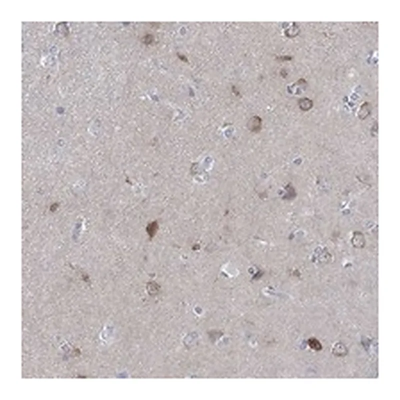 Atlas Antibodies Anti-WASF3 Antibody