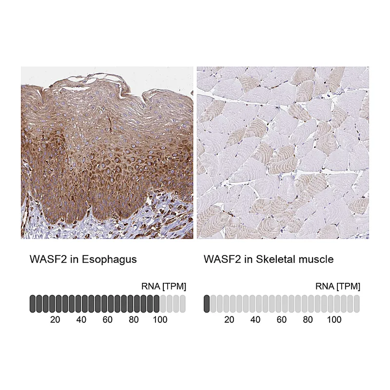 Atlas Antibodies Anti-WASF2 Antibody
