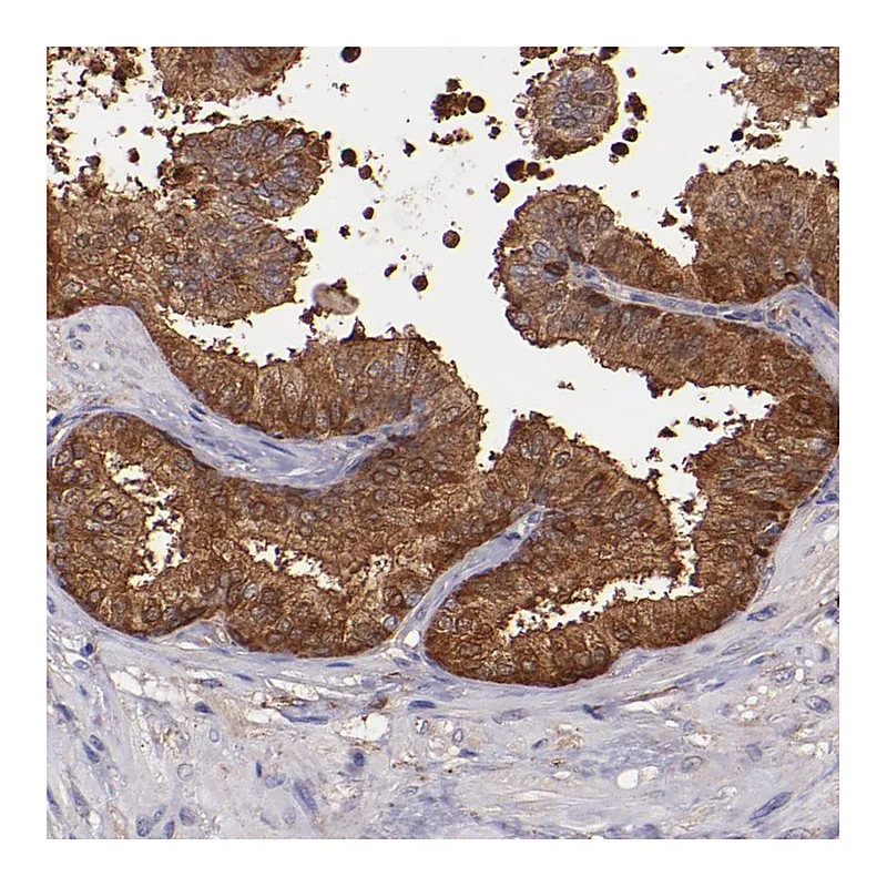 Atlas Antibodies Anti-WASHC1 Antibody