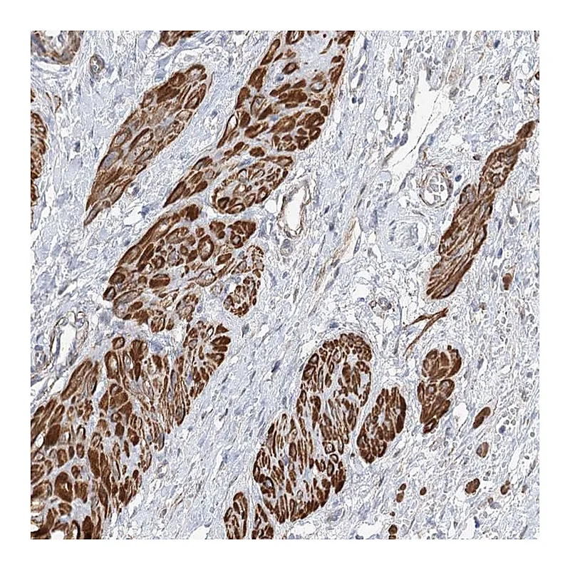 Atlas Antibodies Anti-WASHC3 Antibody
