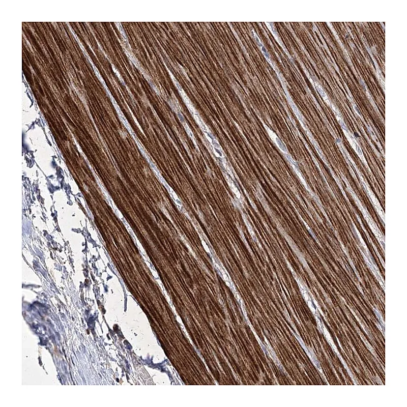 Atlas Antibodies Anti-WASHC3 Antibody