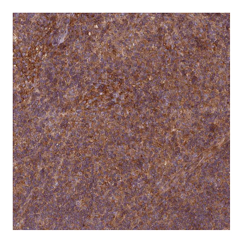 Atlas Antibodies Anti-WASHC2A Antibody
