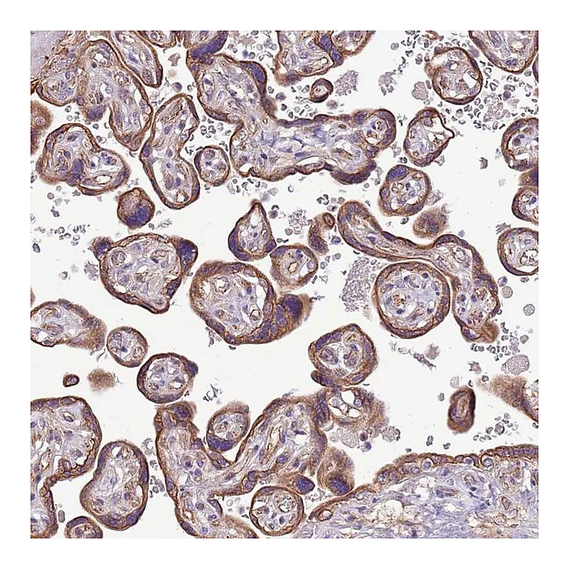 Atlas Antibodies Anti-WASHC4 Antibody
