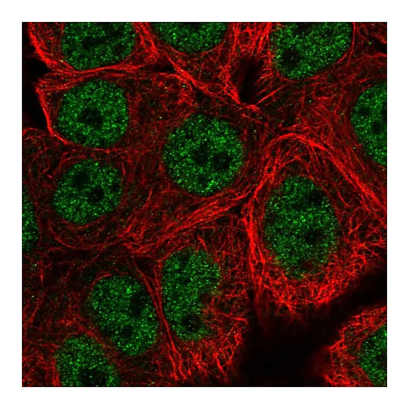 Atlas Antibodies Anti-WASHC5 Antibody