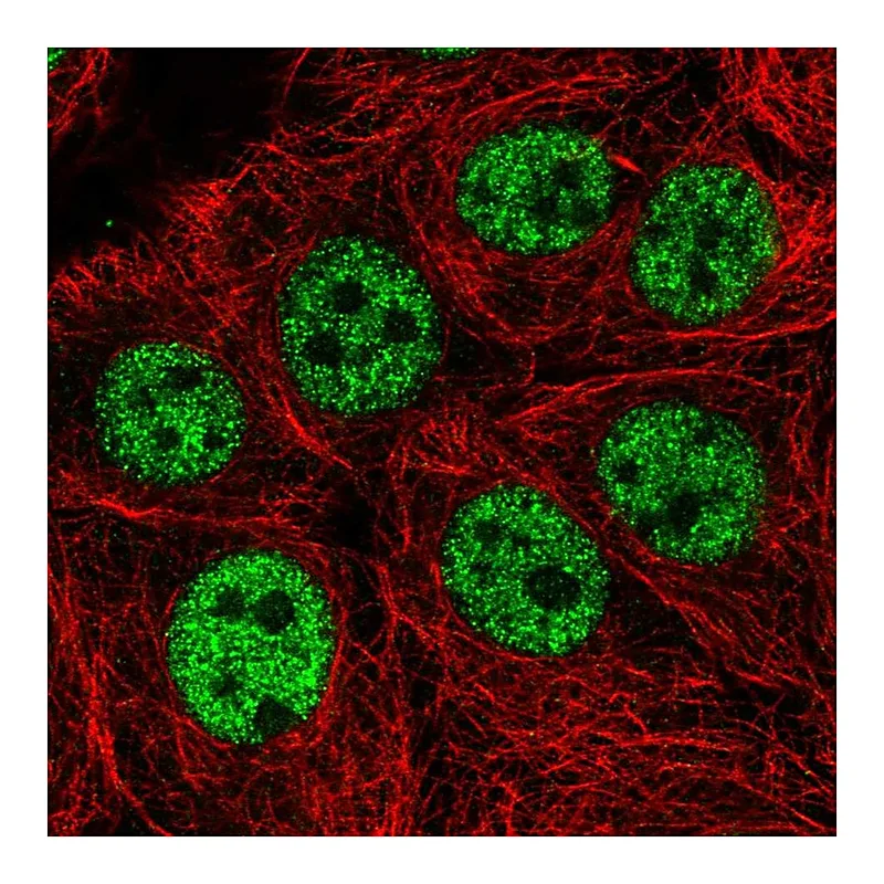 Atlas Antibodies Anti-WASHC5 Antibody