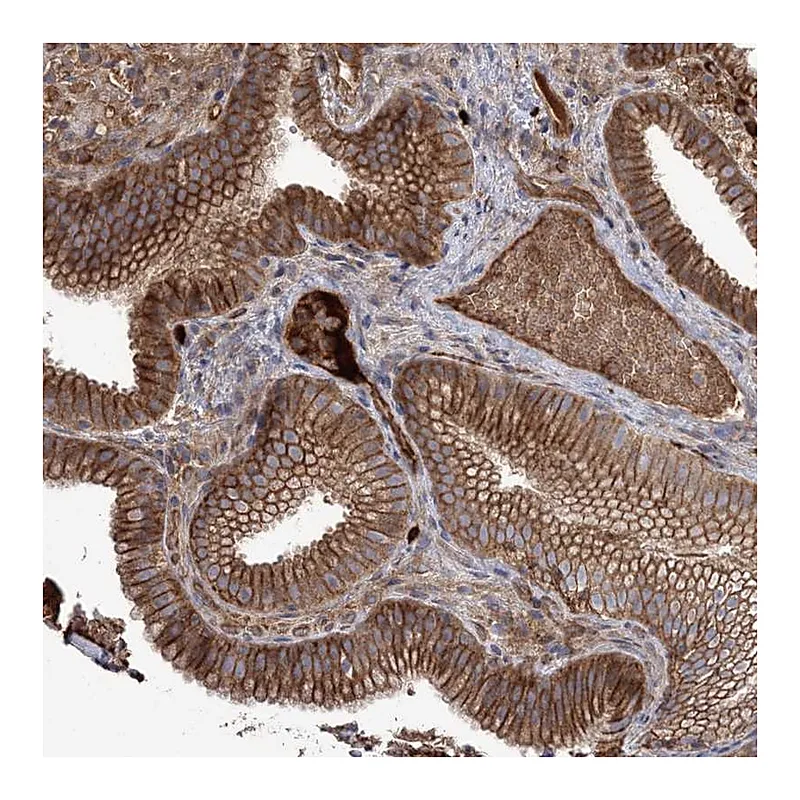 Atlas Antibodies Anti-WBP1L Antibody