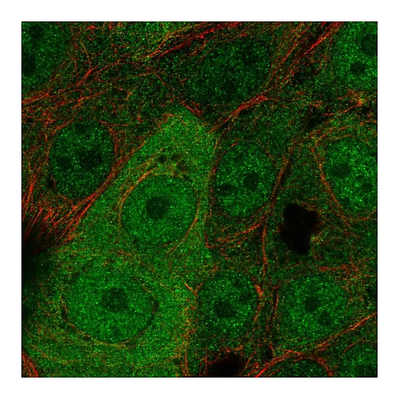 Atlas Antibodies Anti-WBP2 Antibody