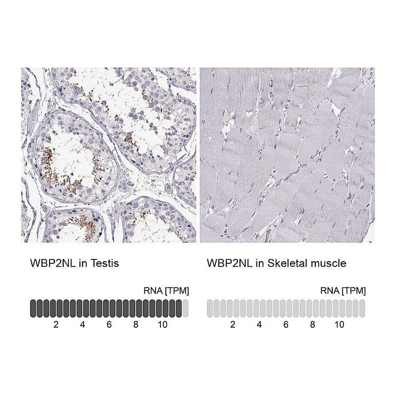 Atlas Antibodies Anti-WBP2NL Antibody