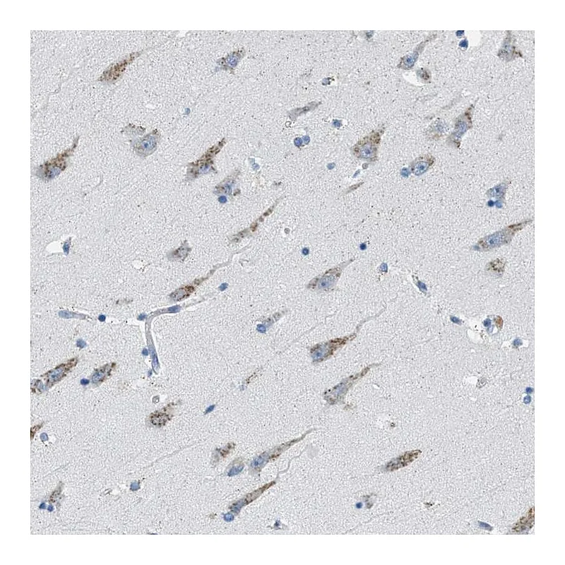 Atlas Antibodies Anti-WBSCR17 Antibody